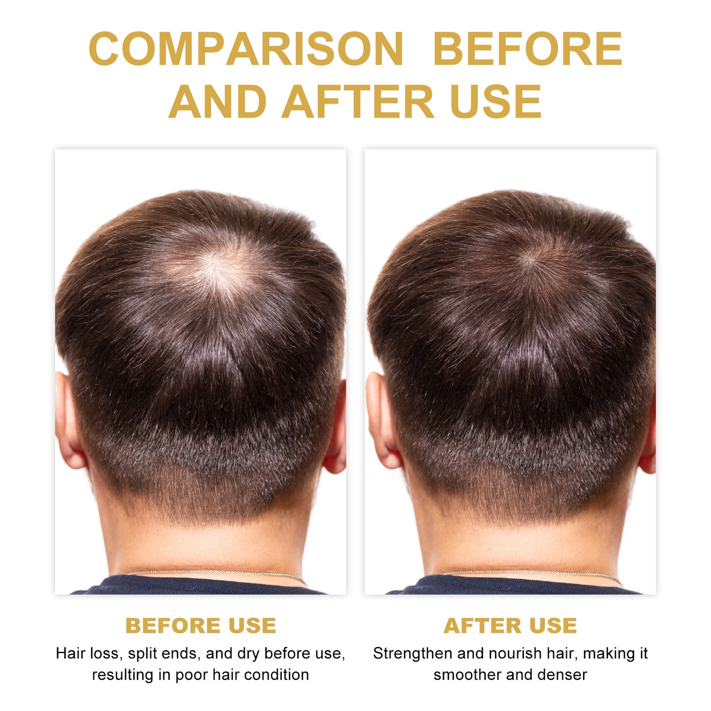 EELHOE Rosemary Hair Treatment Oil – Scalp Nourishing, Repair & Frizz Control