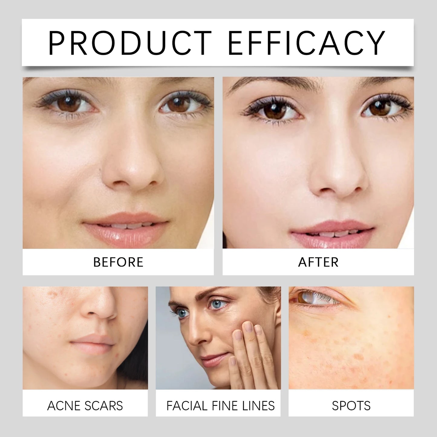 Hoygi Vitamin C Brightening Cream – Dark Spot Correcting, Lightweight Hydrating Antioxidant Moisturizer